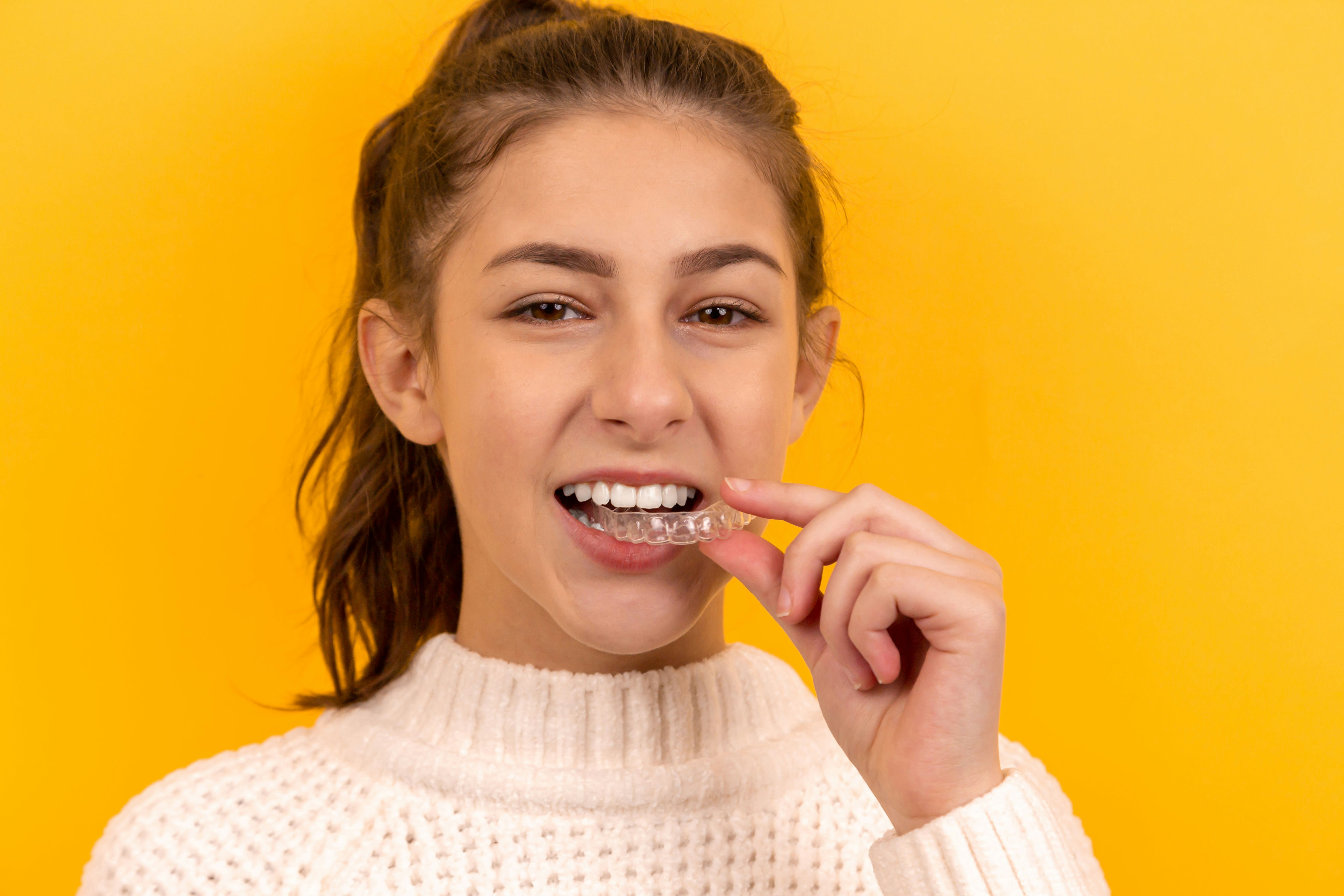 Invisible Aligners